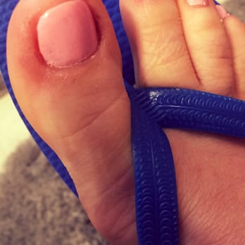 Bethpage Nail & Spa. - Is that a shape regularly done on a toenail and was perfectly square to begin with ? - Nail Salons Near Me - Bethpage, New York