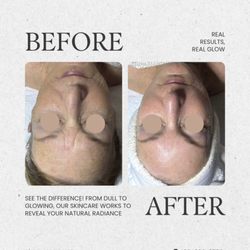 Facial