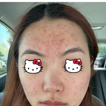 Beauty Legend - 6/7/25 - Skin Care Near Me - Fremont, California Beauty Legend - 6/7/25 - Skin Care Near Me - Fremont, California