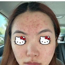 Beauty Legend - 6/7/25
