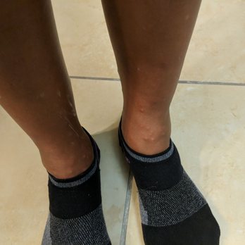 Residence Inn by Marriott Temple - Ankles with multiple bites. - Hotels Near Me - Temple, Texas Residence Inn by Marriott Temple - Ankles with multiple bites. - Hotels Near Me - Temple, Texas