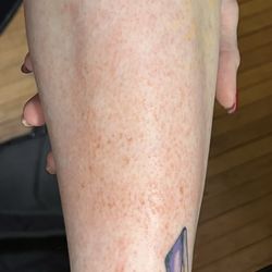 LA Nails - See the damage caused by their pumice stone! Almost 12 hrs later, it is still burning! And I'm unable to work until they heal.
