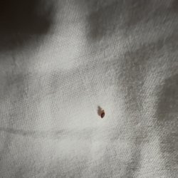 Hôtel Novotel Paris 14 Porte d'Orléans - A bed bug looks like a moving watermelon seed.  They move steadily and are attracted to carbon dioxide from one's breath.