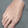 Medical Art Prosthetics