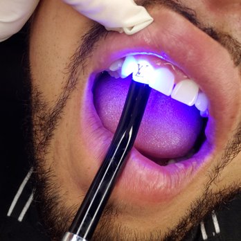 The Perfect You By J - Teeth Whitening Near Me