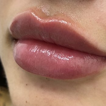 LaserAway - Front - Laser Hair Removal Near Me - Walnut Creek, California LaserAway - Front - Laser Hair Removal Near Me - Walnut Creek, California
