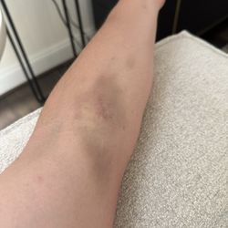 American Red Cross - 3 days later