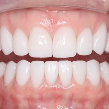 William C Strupp, DDS - General Dentistry Near Me - Clearwater, Florida William C Strupp, DDS - General Dentistry Near Me - Clearwater, Florida