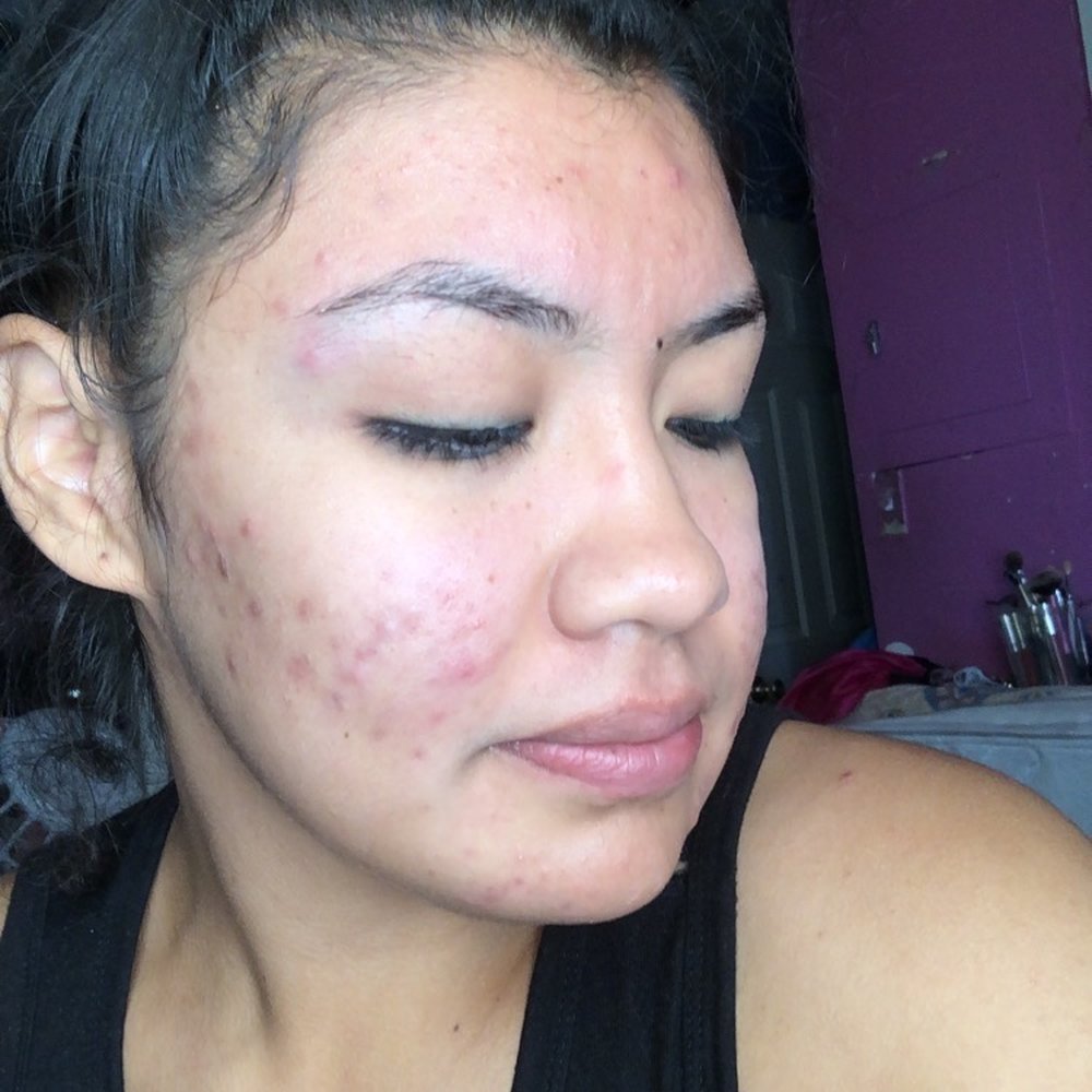 AvantGard Spa - Skin Care Near Me - San Carlos, California
