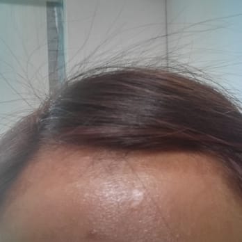 3Sixty Salon - Dye on my forehead that wasn't cleaned - Hair Salons Near Me - Fremont, California 3Sixty Salon - Dye on my forehead that wasn't cleaned - Hair Salons Near Me - Fremont, California