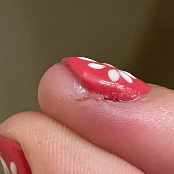 Le Nails - See chunk missing and swollen nails. Brown from dried blood. - Nail Salons Near Me - Los Angeles, California Le Nails - See chunk missing and swollen nails. Brown from dried blood. - Nail Salons Near Me - Los Angeles, California