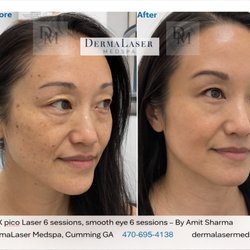DermaLaser Medspa