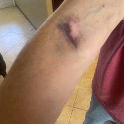 Quest Diagnostics - Horrible
