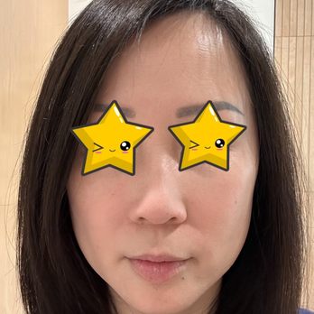 Joanna Chan, MD - Dynasty Dermatology - I had no makeup on - Dermatologists Near Me - Pasadena, California Joanna Chan, MD - Dynasty Dermatology - I had no makeup on - Dermatologists Near Me - Pasadena, California