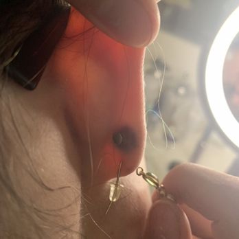 Adorn East - Right ear. Not as painful bruise. But a fully healed first lobe with no problems. - Piercing Near Me - Portland, Oregon Adorn East - Right ear. Not as painful bruise. But a fully healed first lobe with no problems. - Piercing Near Me - Portland, Oregon