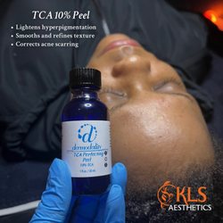 KLS Aesthetics - KLS has had amazing results on dark skin with this peel.