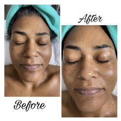 Soft Skin - Facial