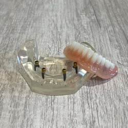 Omaha Dentures And Implants - Snap-In Implant Dentures