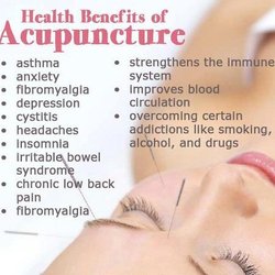 Best Burbank Acupuncture & Herbs - The benefits of acupuncture.