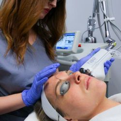 WrinkleFree MD - Halo fractional laser
