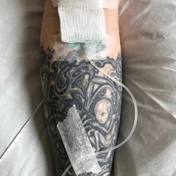 Barbara Rush, ND - Tattooed Arm with IV - Alternative Medicine Near Me - Laguna Beach, California