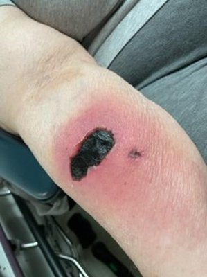 Javon Bea Hospital—Riverside by null