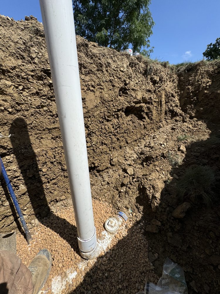 Slide of Pfeuffer Contracting