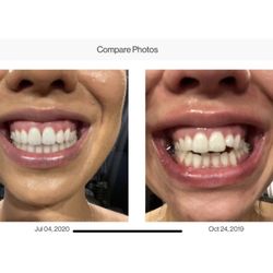 Family Dentistry 2000 - Invisalign Treatment