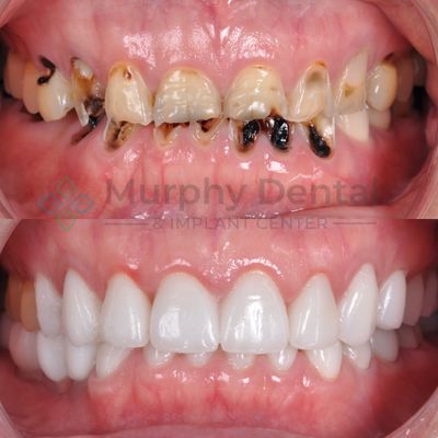 Murphy Dental and Implant Center