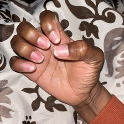 Nails So Happy - Damaged nail