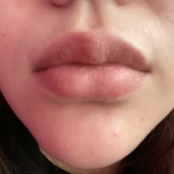 Solara Skin & Laser Center