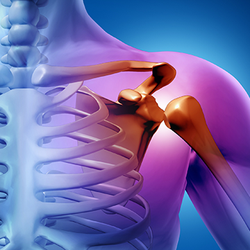 Lori G. Weiser, MD