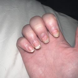 Le nails & spa - Damage nails