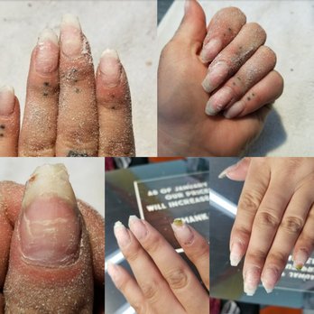 Shine Nail Lounge - Before  :( - Nail Salons Near Me - Capitola, California