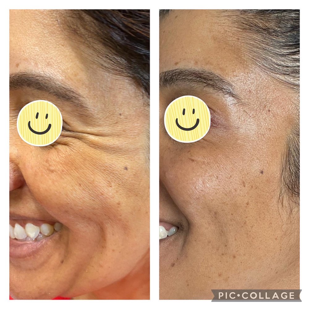 Bliss Health & Wellness Logo