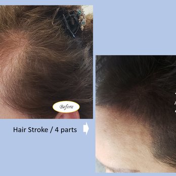 Sharon Permanent Makeup - Bald Cover Tattoo - Permanent Makeup Near Me - Los Angeles, California Sharon Permanent Makeup - Bald Cover Tattoo - Permanent Makeup Near Me - Los Angeles, California