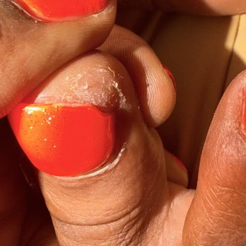 Nail Fever - My toe is actually swollen possible infected. Pedicure was refunded as I only sat in water. Clearly. Still paid for horrible chipped mani. - Nail Salons Near Me - Antioch, California Nail Fever - My toe is actually swollen possible infected. Pedicure was refunded as I only sat in water. Clearly. Still paid for horrible chipped mani. - Nail Salons Near Me - Antioch, California