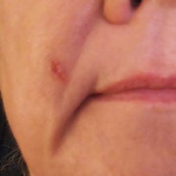 San Marcos Dermatology - Dermatologists Near Me - San Marcos, Texas San Marcos Dermatology - Dermatologists Near Me - San Marcos, Texas
