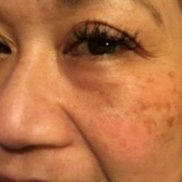 A day after a lash refill A day after a lash refill