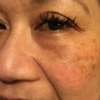 Dazzling Lashes - A day after a lash refill - Eyelash Service Near Me - San Francisco, California Dazzling Lashes - A day after a lash refill - Eyelash Service Near Me - San Francisco, California