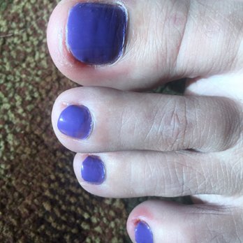 Happy Nails - Big toe and 4th toe are bleeding - Nail Salons Near Me - Durango, Colorado