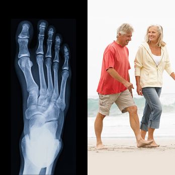 Independence Foot And Ankle Associates - Independence Foot And Ankle Associates, LLC - Podiatrists Near Me - Blue Bell, Pennsylvania Independence Foot And Ankle Associates - Independence Foot And Ankle Associates, LLC - Podiatrists Near Me - Blue Bell, Pennsylvania