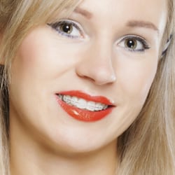 Convivial Dental - Have a beautiful, confident smile - even while wearing your discreet braces