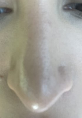 Shah Aesthetic Surgery - Rhinoplasty and Facelift Specialist by null