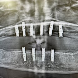 Alan Lavian, DDS