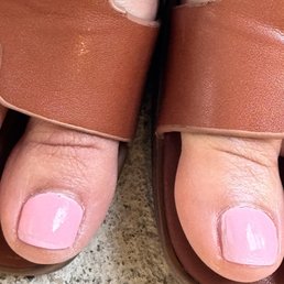 Look at the sides and tip of the toe nail. Terrible job