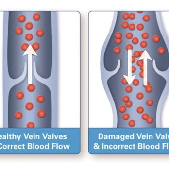 VeinInnovations - Vascular Medicine Near Me - Suwanee, Georgia VeinInnovations - Vascular Medicine Near Me - Suwanee, Georgia