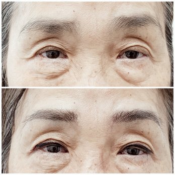 By Soo Cosmetic Tattoo - Before and after microbladed brows and top eyeliner - Permanent Makeup Near Me - Arcadia, California By Soo Cosmetic Tattoo - Before and after microbladed brows and top eyeliner - Permanent Makeup Near Me - Arcadia, California