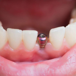 NÜVA Smile - Service of New Jersey Dental Centers | Fort Lee, NJ