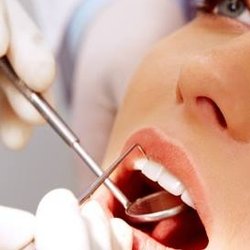 Dental Excellence Bay Area